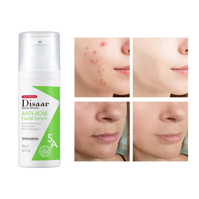 Serum Facial Anti Acne 50ml