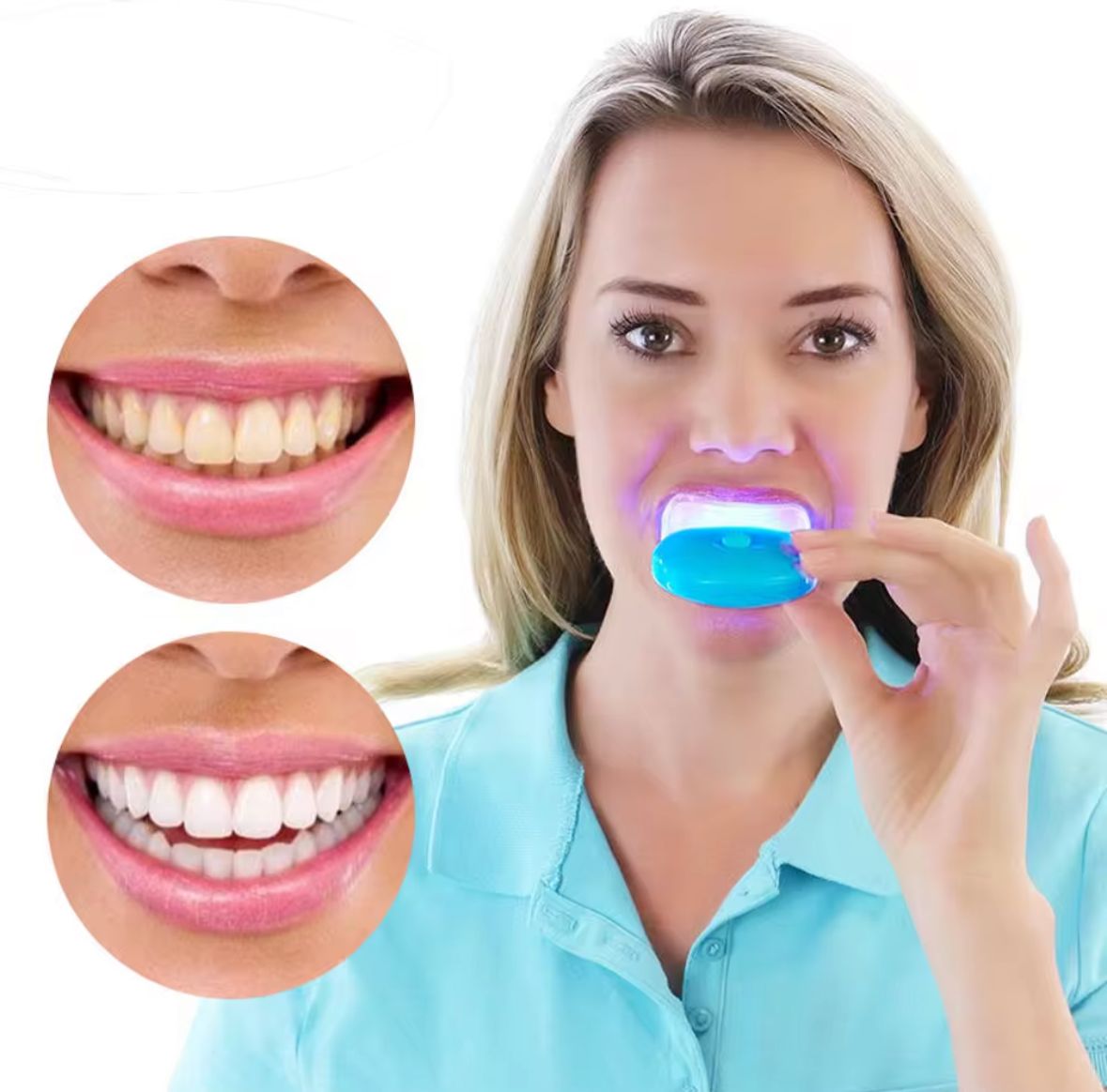GEL DE DIENTE BLANQUEADOR CON LUZ LED
